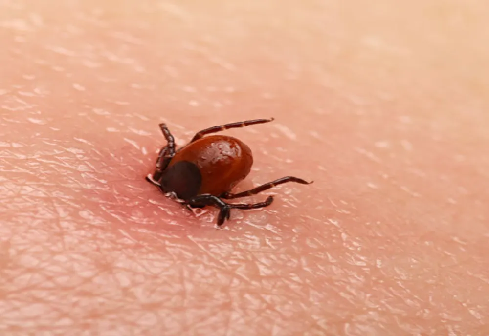 Ce trebuie să facem dacă ne mușcă o căpușă. Sfatul medicilor